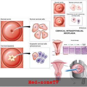 Cervical cytology